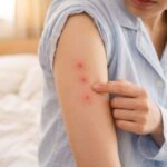 朝、寝室で日本人の女性が自分の腕にある直線状に並んだ3つの虫刺され跡(点々3つ)を指さして心配そうに見つめているクローズアップ写真。トコジラミの連続吸血行動を示唆する症状。
